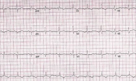 Cardiology Case Report: Older Man with Near Syncope