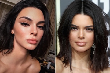 See Kendall's changing face as fans think she secretly got nose job & more