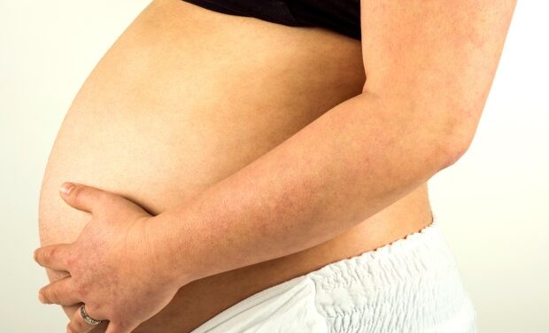 Black women with history of hypertensive disorders of pregnancy have 66% increased risk of stroke, study finds