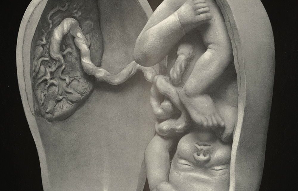 At the 1939 World’s Fair, Robert Latou Dickinson Demystified Pregnancy for a Curious Public