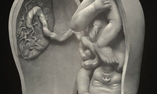 At the 1939 World’s Fair, Robert Latou Dickinson Demystified Pregnancy for a Curious Public
