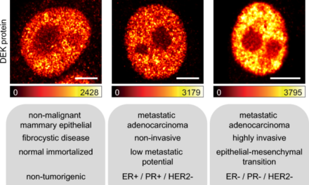 Imaging-based study demonstrates how the DEK nanoscale distribution differentially correlates with epigenetic marks in a breast cancer model