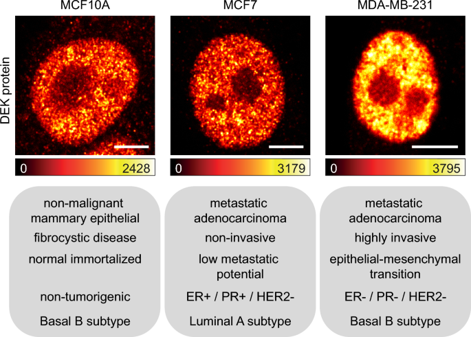 Imaging-based study demonstrates how the DEK nanoscale distribution differentially correlates with epigenetic marks in a breast cancer model