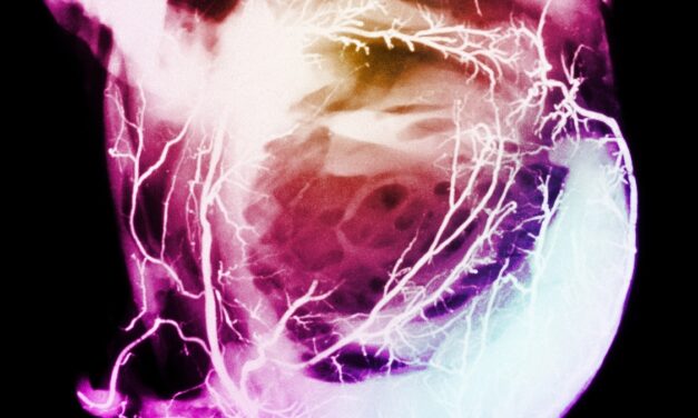 Why heart attacks are rising in young adults—and what to watch out for