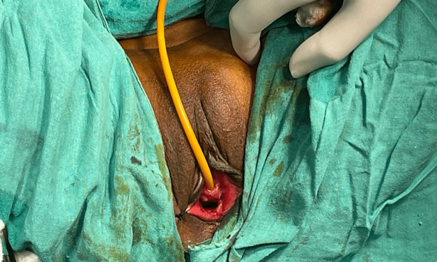 Aesthetic Gynaecology: What Women Want?