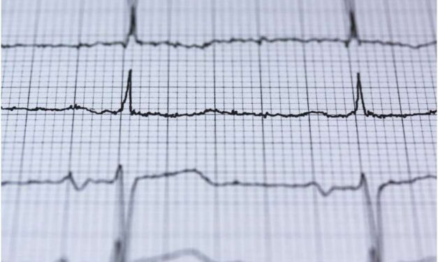 Stress and insomnia for women linked to irregular heart rhythms after menopause