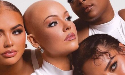 Baldy Lox Boutique Is Empowering The Hair Loss Community