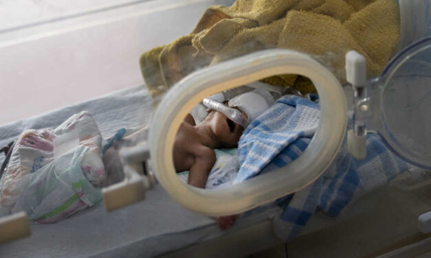 There’s a glimmer of hope on Yemen’s war front. Yet children are still dying of hunger