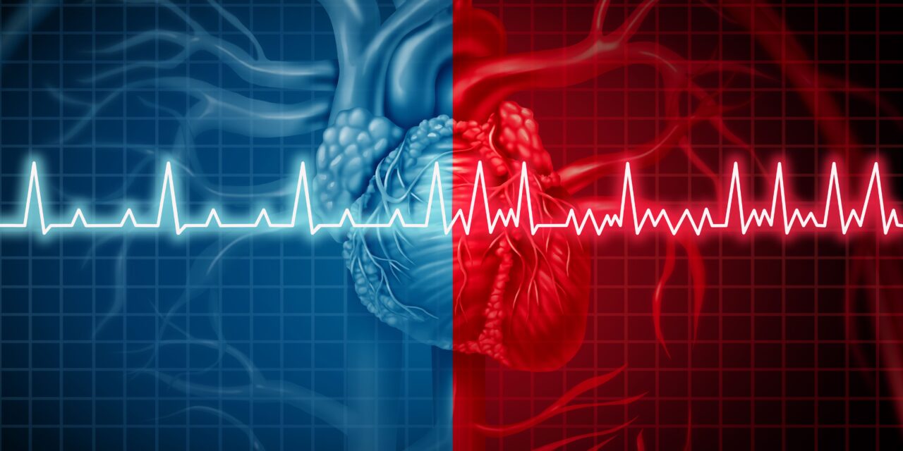 The Rise of Atrial Fibrillation Has More Than Doubled Over 30 Years