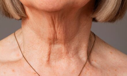 Help for the #1 Beauty Blindspot for Women Over 50: A Crepey Neck