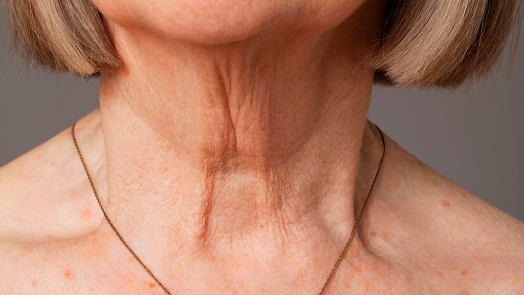 Help for the #1 Beauty Blindspot for Women Over 50: A Crepey Neck