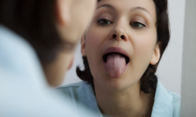 What color is your tongue? What’s healthy, what’s not? – Harvard Health