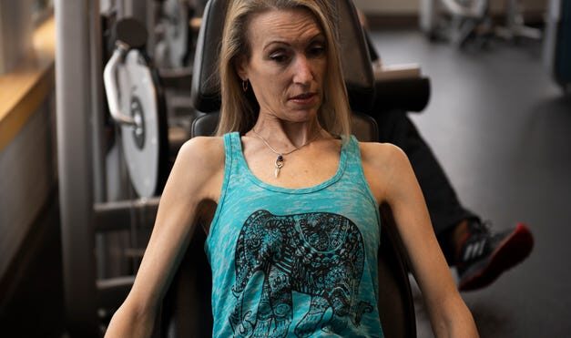 After coma, this Texas student didn’t know lupus ran in her family. Now she graduated college