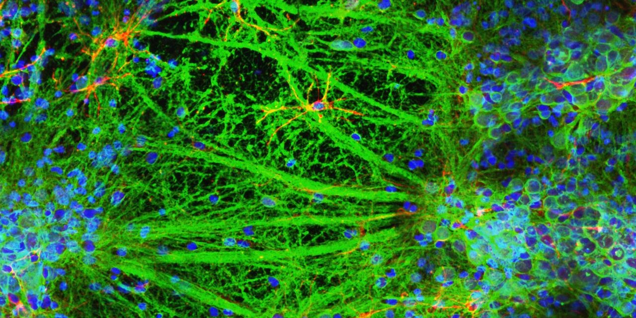 A Lab Just 3D-Printed a Neural Network of Living Brain Cells