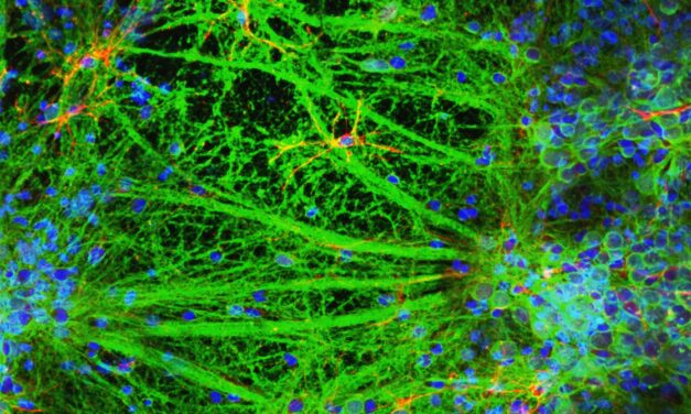 A Lab Just 3D-Printed a Neural Network of Living Brain Cells