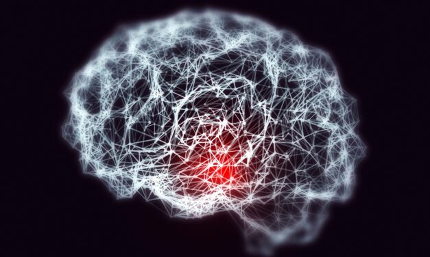 Clinical Overview: Comparison of Anti-Amyloid Monoclonal Antibodies for Alzheimer Disease