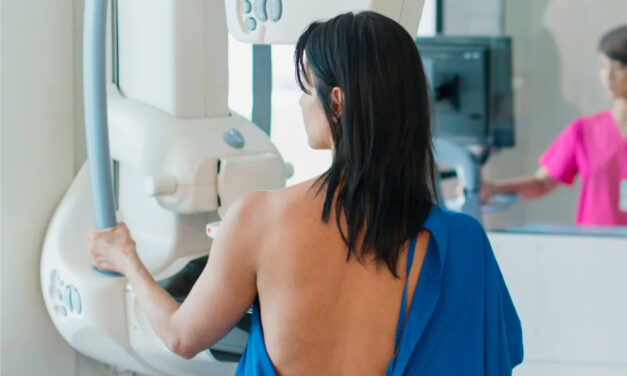 Mammograms at 40? Breast cancer screening guidelines spark fresh debate