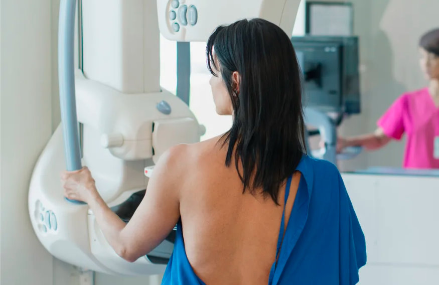 Mammograms at 40? Breast cancer screening guidelines spark fresh debate