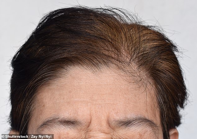 By the age of 60 you're lucky to have any hair left at all, and what there is has probably gone grey, or even white. For some reason it is perfectly acceptable for women to dye their hair all sorts of unusual colours, but when a man dyes his hair any colour at all, it looks ridiculous (Stock Image)