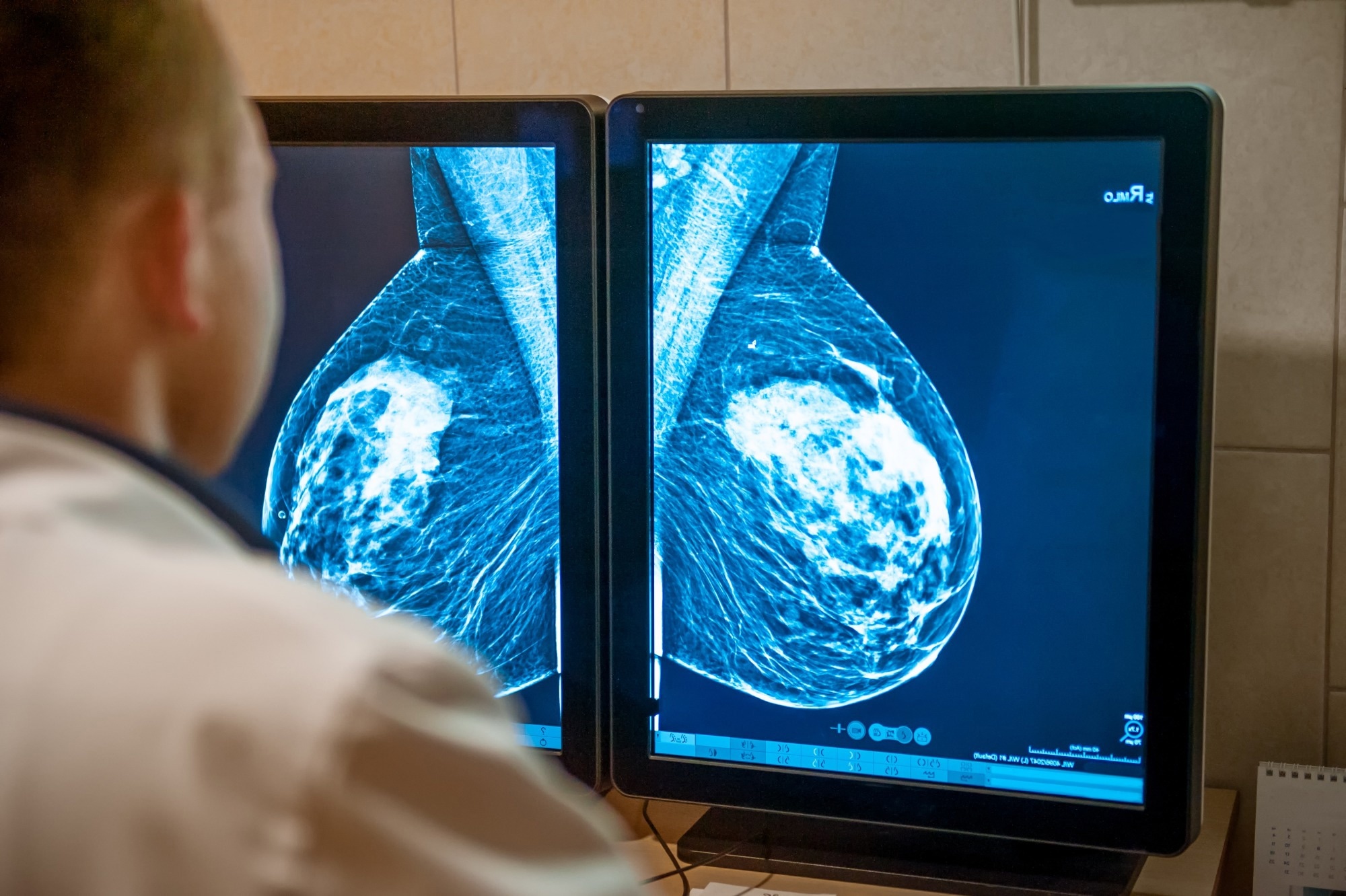 Study: Sociodemographic variations in women’s reports of discussions with clinicians about breast density. Image Credit: Okrasiuk / Shutterstock.com