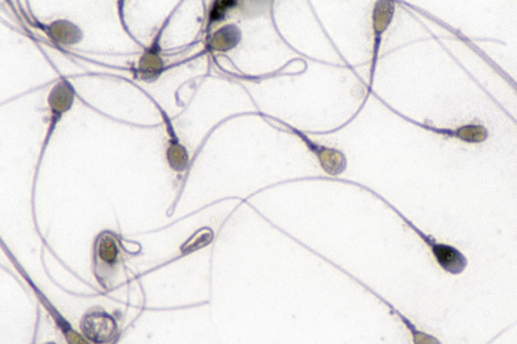 Microscopy image of sperm that appear to be immoblized.